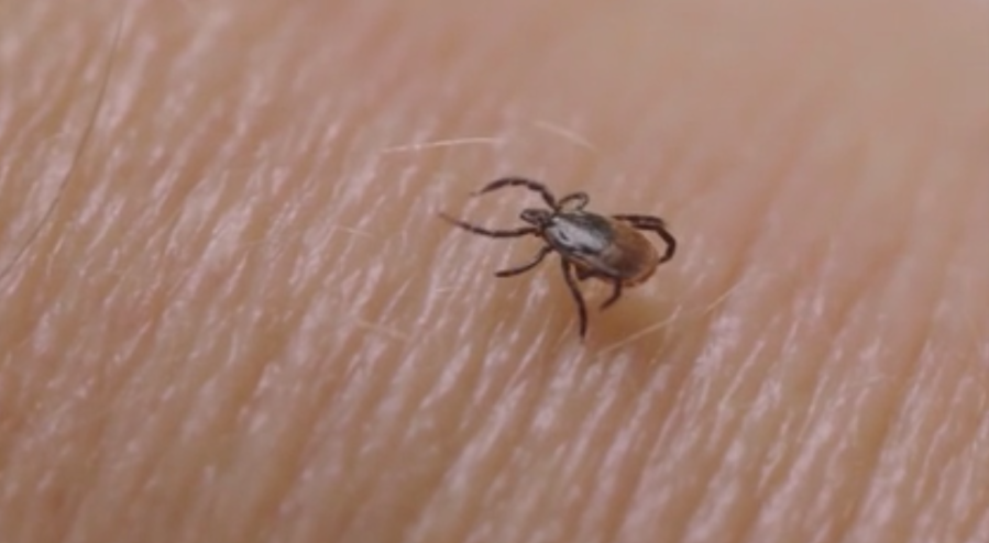 How common is it to get Lyme disease in Tennessee? Justin Timberlake announces ‘debilitating’ diagnosis 